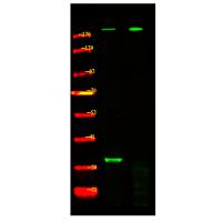 Tuberin (Phospho-Ser981) Antibody