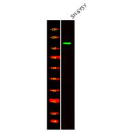 Ack1 (Phospho-Tyr857+Tyr858) Antibody