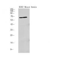 PFKFB2 (Phospho-Ser466) Antibody