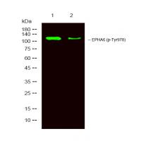 EPHA6 (Phospho-Tyr977) Antibody