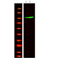 ROR2 (Phospho-Ser449) Antibody