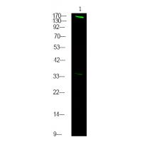 FANCD2 (Phospho-Thr691) Antibody
