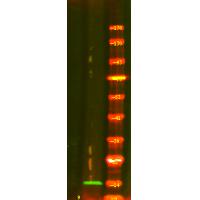 S100A9 (Phospho-Thr113) Antibody