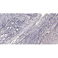 LRP6 (Phospho-Ser1490) Antibody