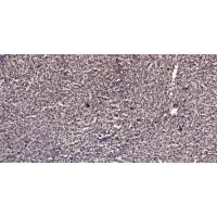 Ataxin 1 (Phospho-Ser776) Antibody