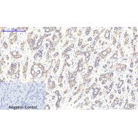 CaMK2- beta/ gamma/ delta (Phospho-Thr287) Antibody