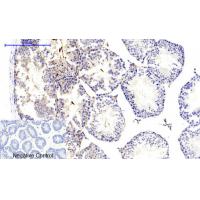 CaMK2- beta/ gamma/ delta (Phospho-Thr287) Antibody