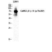 CaMK2- beta/ gamma/ delta (Phospho-Thr287) Antibody