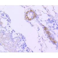 B Raf Rabbit mAb