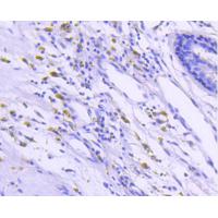 B Raf Rabbit mAb