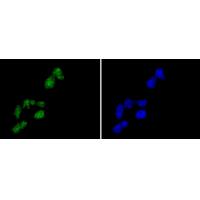 Histone H2A.Z Rabbit mAb