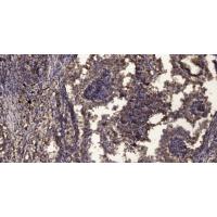 PLC β2 Polyclonal Antibody