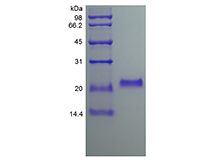 Recombinant Human Osteoprotegerin