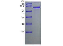 Recombinant Human Protein Disulfide Isomerase