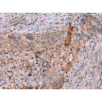KBTBD11 Antibody
