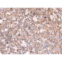 KBTBD11 Antibody
