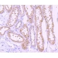 PI 3 Kinase p85 alpha Rabbit mAb