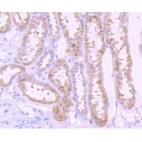 PI 3 Kinase p85 alpha Rabbit mAb