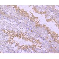 NUR77 Rabbit mAb