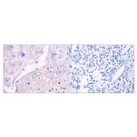 CD93 Antibody
