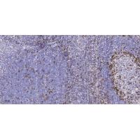 CD105 Polyclonal Antibody
