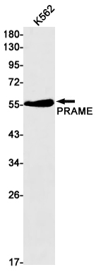 PRAME Rabbit mAb