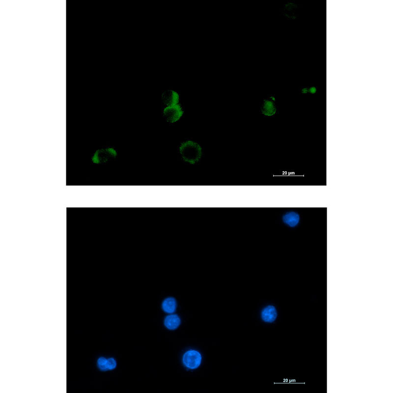 Prostaglandin D Synthase Rabbit mAb