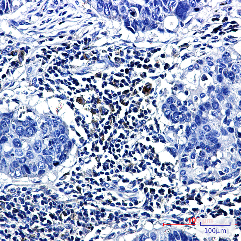 Prostaglandin D Synthase Rabbit mAb