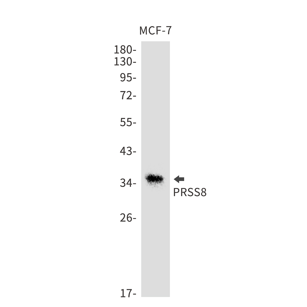 PRSS8 Rabbit mAb