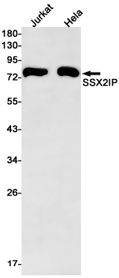 SSX2IP Rabbit mAb