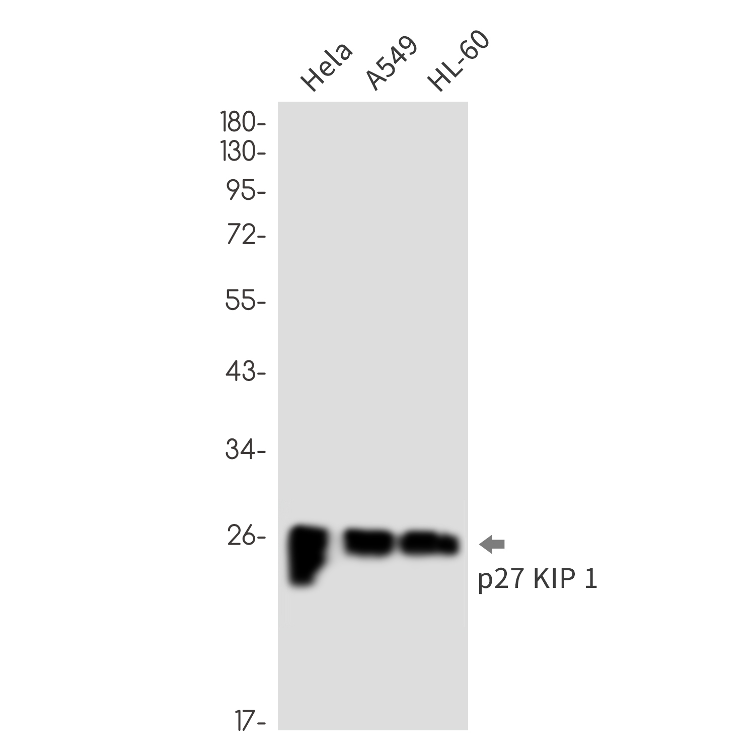 p27 Kip 1 Rabbit mAb