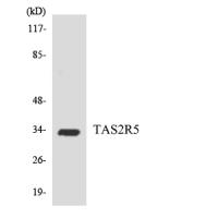 T2R5 Polyclonal Antibody