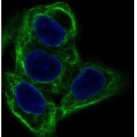 Cytokeratin 20 Antibody