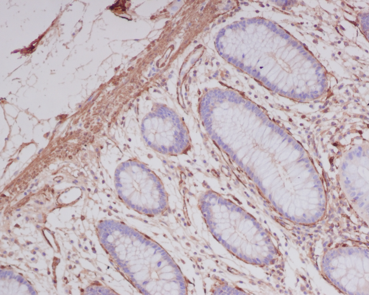alpha smooth muscle Actin Rabbit mAb