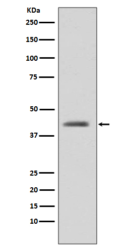GSK3 beta Rabbit mAb