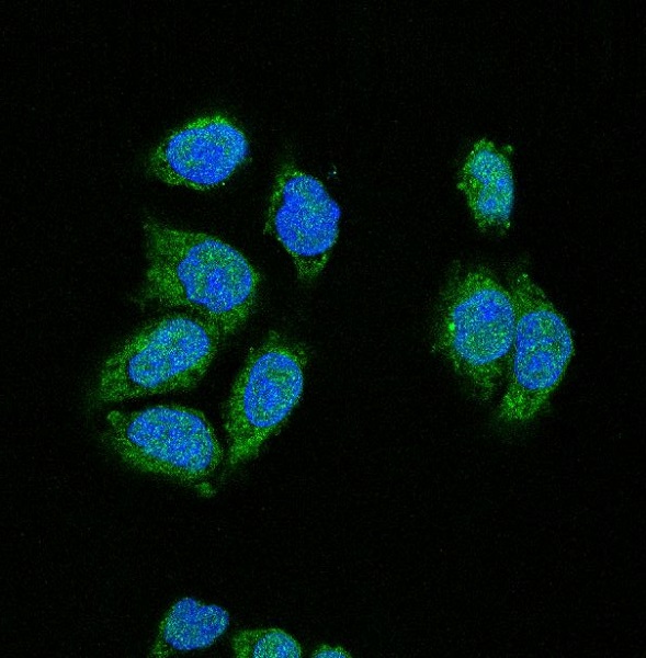 CDK2 Rabbit mAb