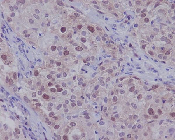 CDK2 Rabbit mAb