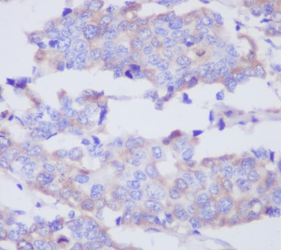 MMP2 Rabbit mAb