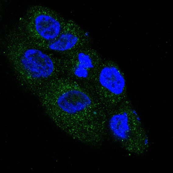 NGF Rabbit mAb