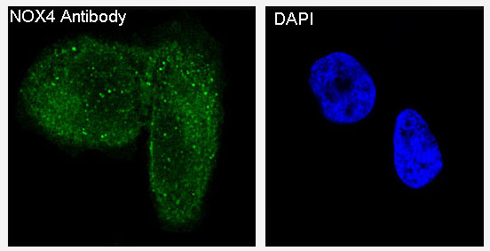 NOX4 Rabbit mAb 