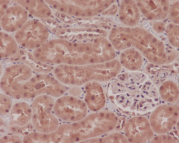 NOX4 Rabbit mAb 