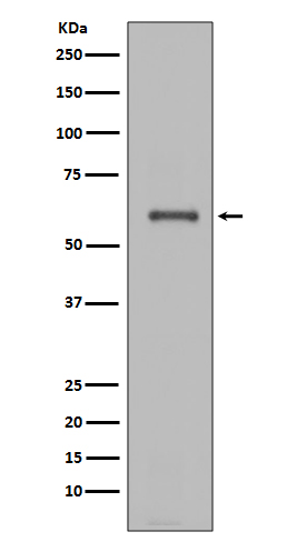 NOX4 Rabbit mAb 