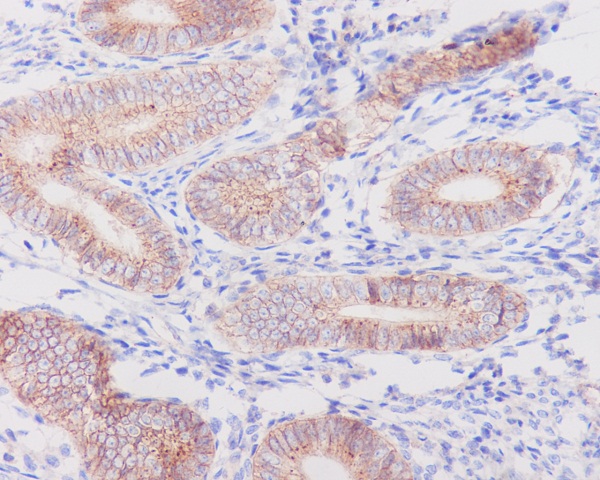 Flotillin 1 Rabbit mAb 