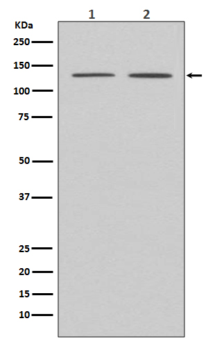 APAF1 Rabbit mAb 