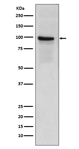 Thrombomodulin Rabbit mAb