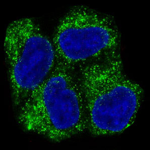 AMPK alpha 1 Rabbit mAb