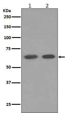 AMPK alpha 1 Rabbit mAb