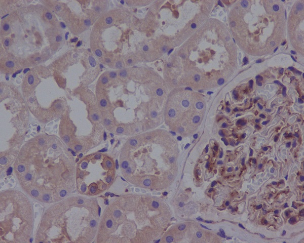 ROCK1 Rabbit mAb