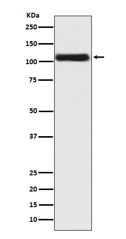 Androgen Receptor Rabbit mAb