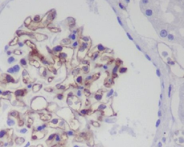 CD31 Rabbit mAb